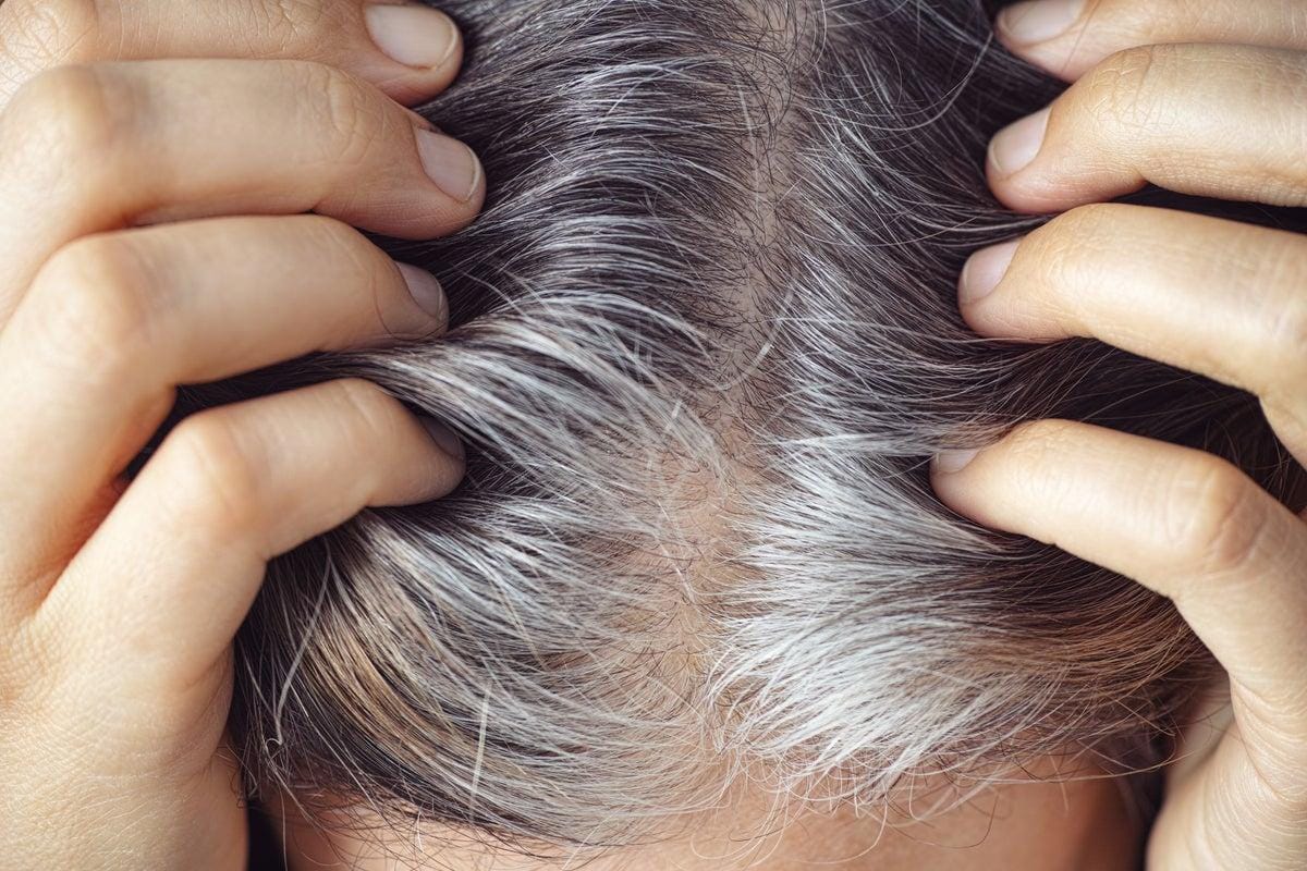 White Hairs