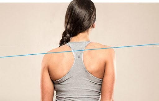 muscle imbalance